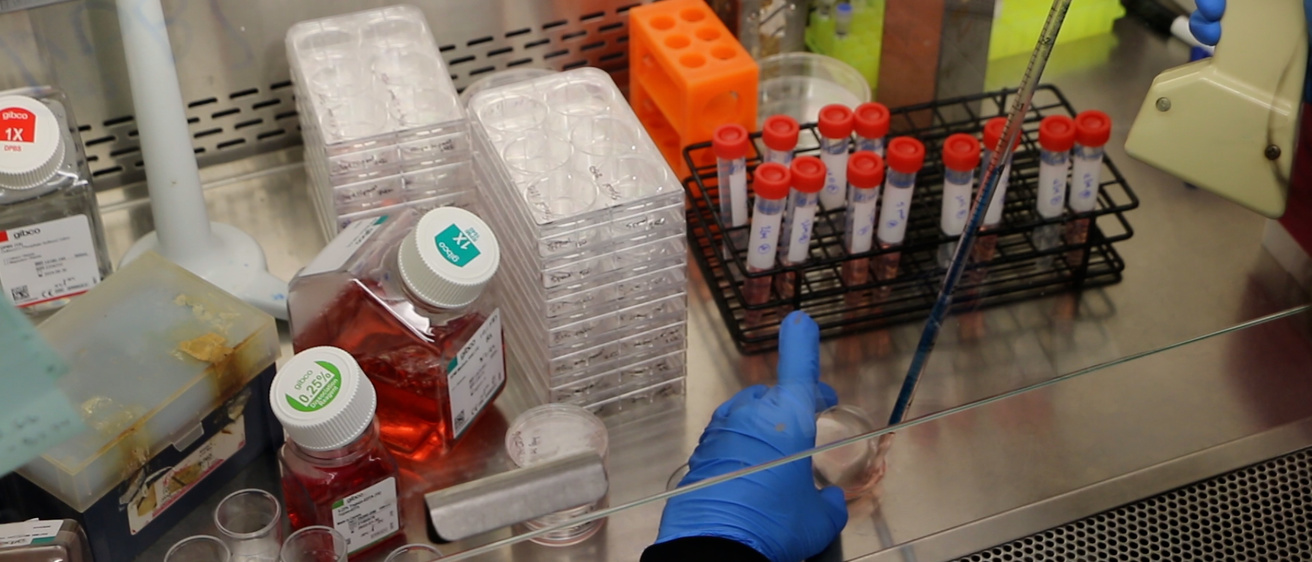 Clonogenic Assay under the hood