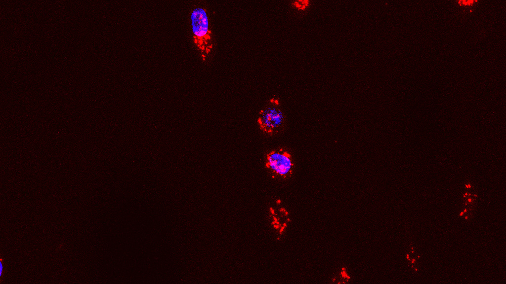 Image from a confocal microscope