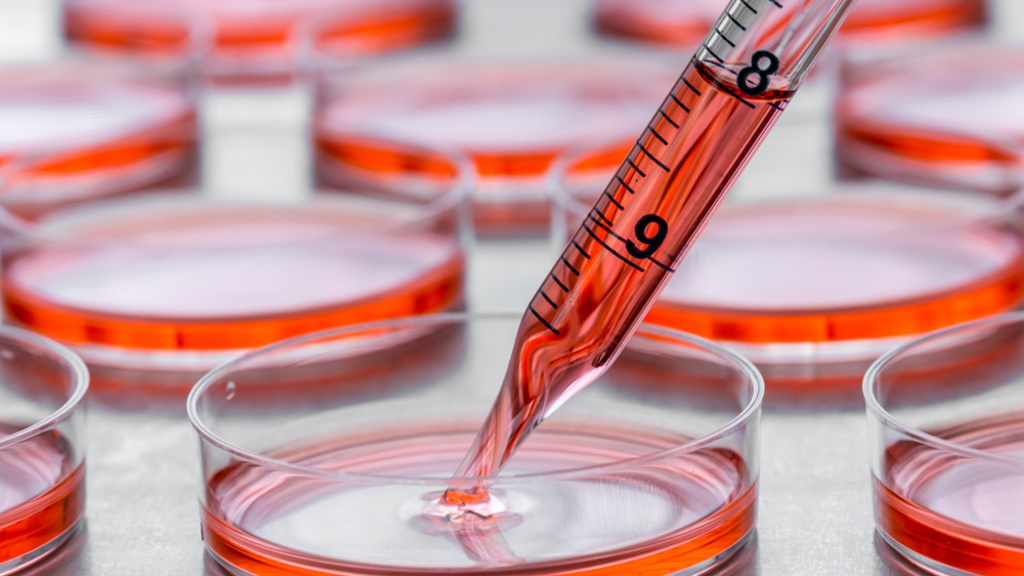 Image of Petri dishes